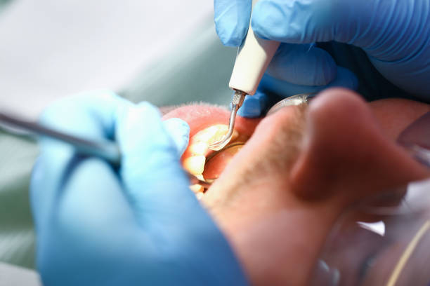 Best Broken Tooth Emergency  in El Paso, TX